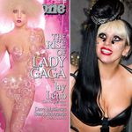 Did Gaga get implants? Compare these old (left) and new (right) photos.